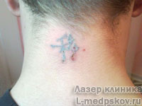 Центр лазеролечения и лазерной косметологии "Лазер Клиника"