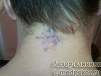 Центр лазеролечения и лазерной косметологии "Лазер Клиника"