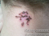 Центр лазеролечения и лазерной косметологии "Лазер Клиника"