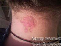 Центр лазеролечения и лазерной косметологии "Лазер Клиника"